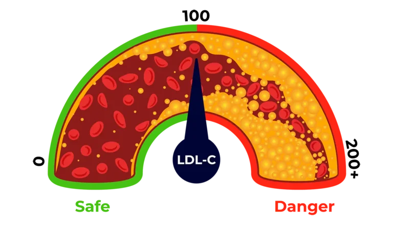 High LDL Raises Risk For A Cardiac Event