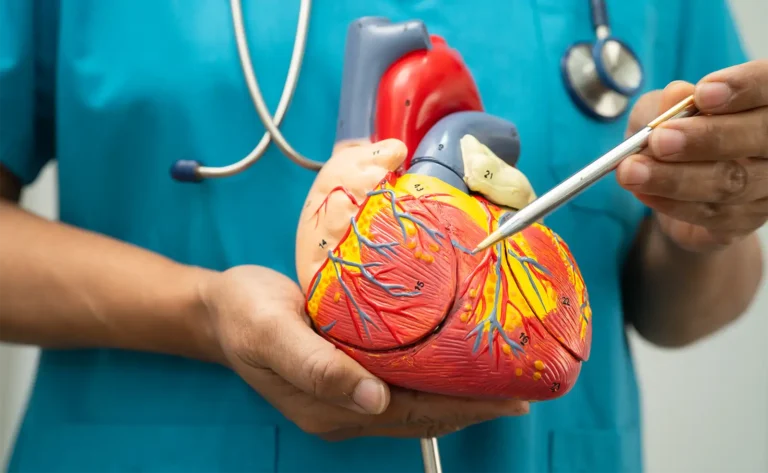 Premature Ventricular Contractions
