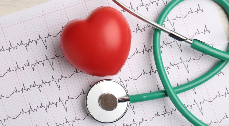 Arrhythmia