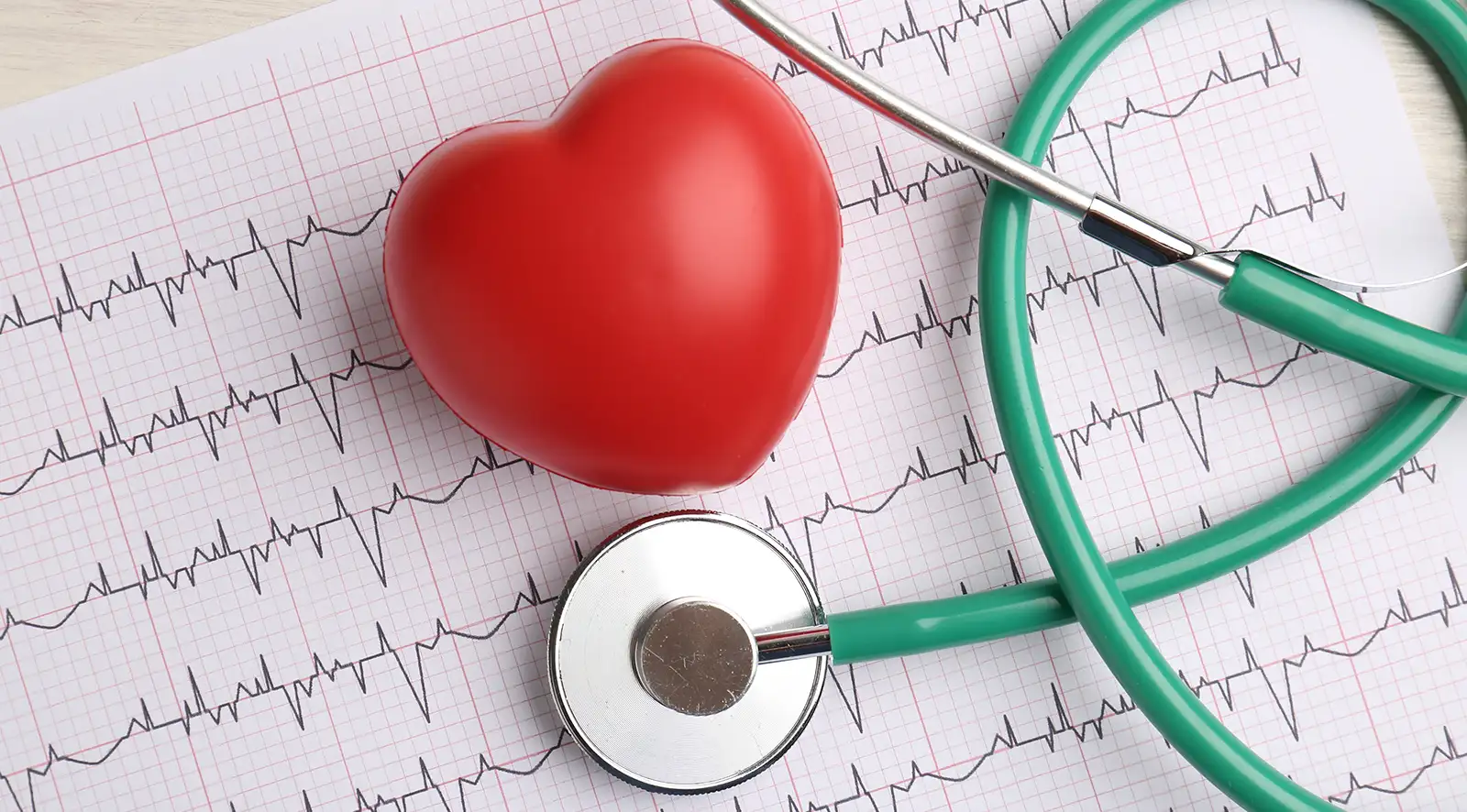 Arrhythmia 19 Arrhythmia