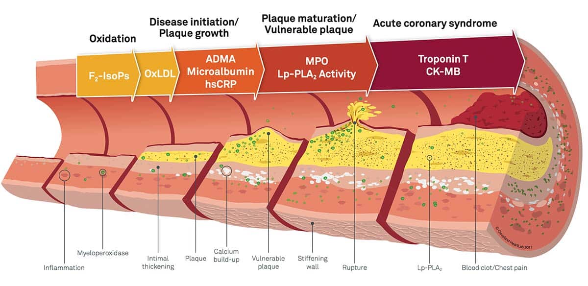 artery wall