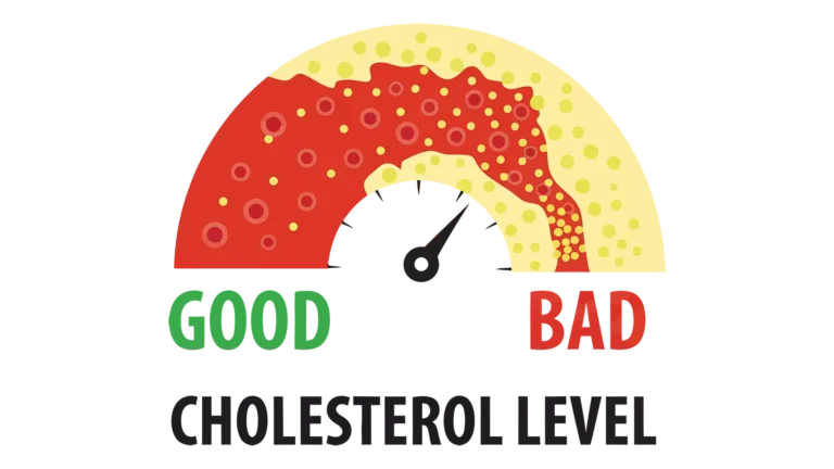 Lpa cholesterol