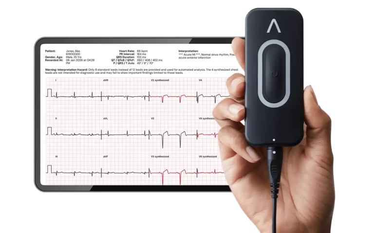 EKG technology