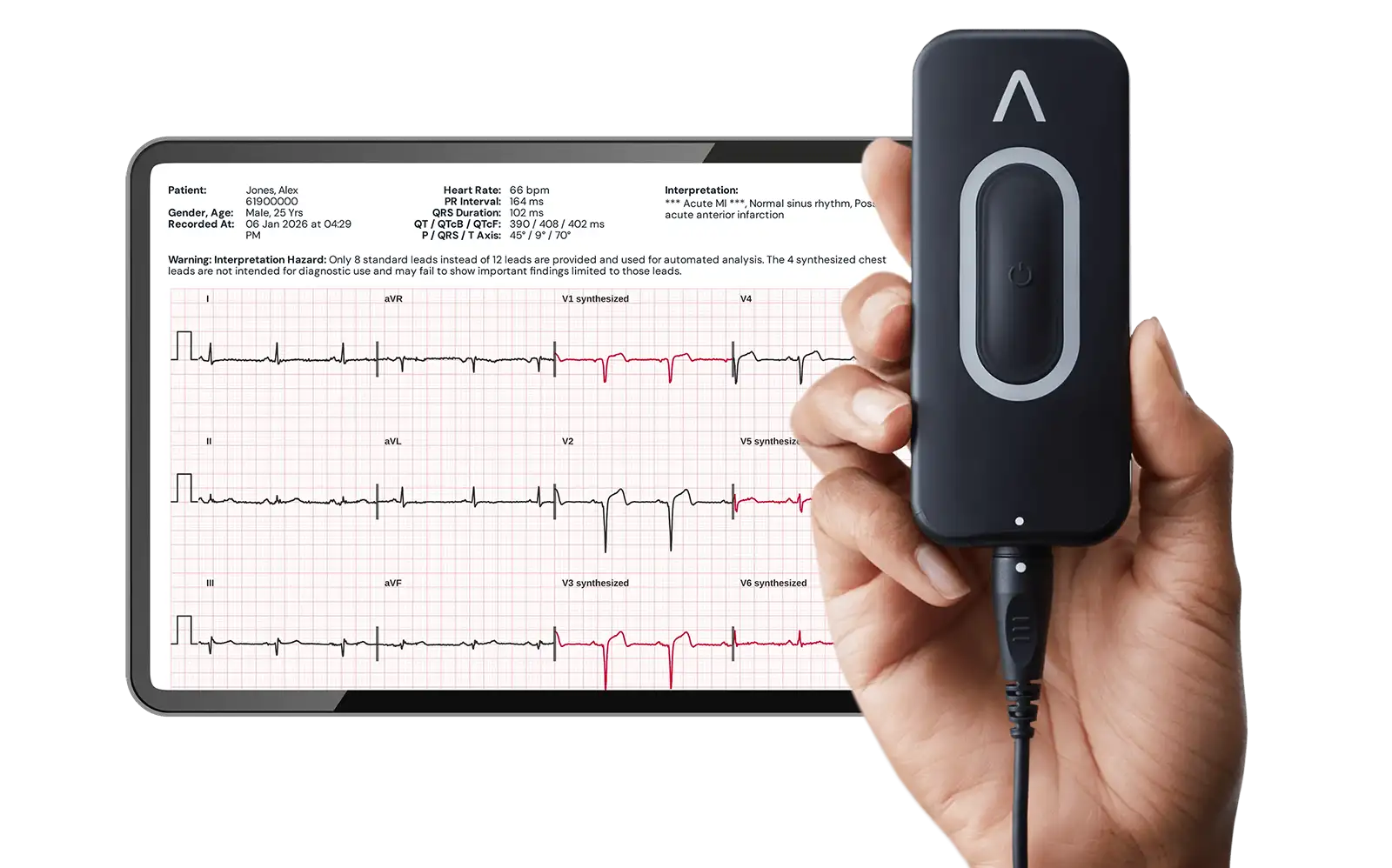 Kardia12L Will Transform Patient Care