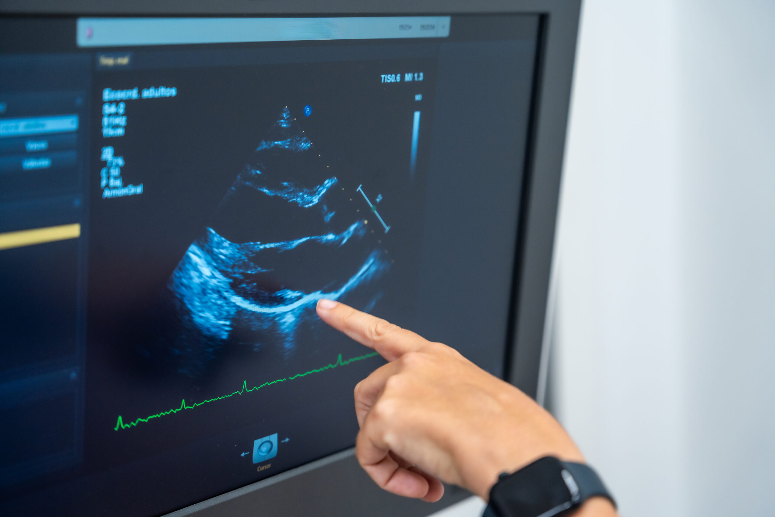 Integrative Cardiology Services │ Holistic Heart Centers, Roslyn NY 2 cardiovascular longevity hero scaled