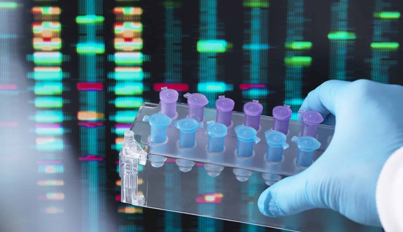 Current Genetic Research for Heart Arrhythmia